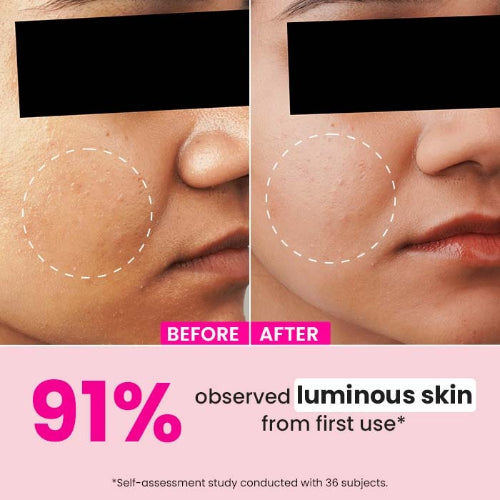 Dot & Key Watermelon & 10% Glycolic Serum