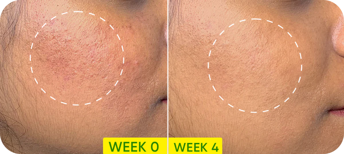 Dot & Key Cica (Centella) + Niacinamide Oil Free Moisturizer